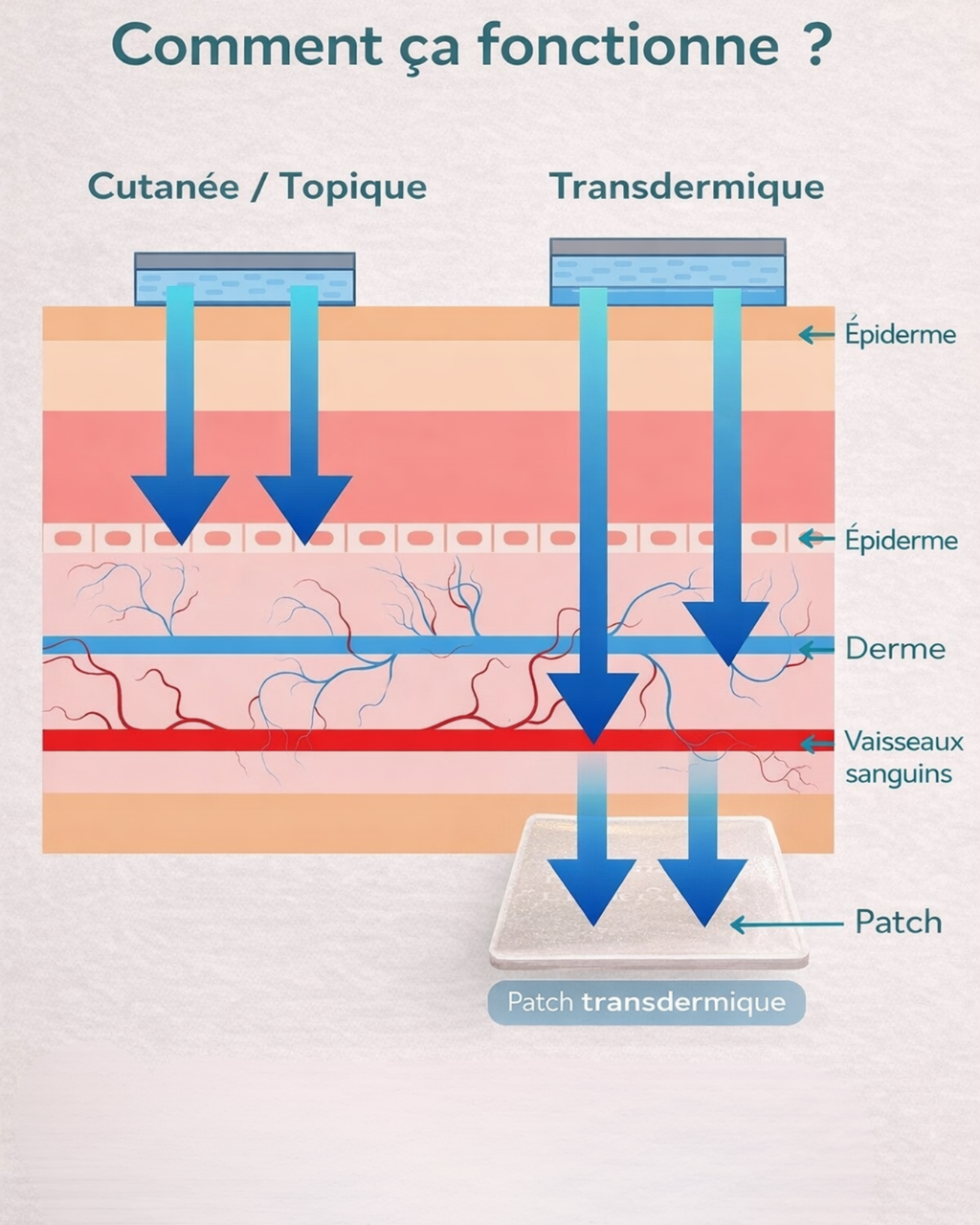 comment fonctionne le patch